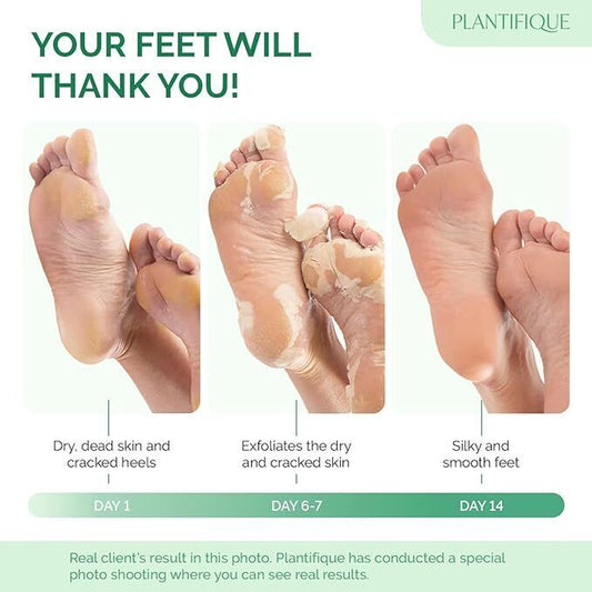 Foot Peel Mask with Peach by Plantifique - 2 Pack Foot Mask Dermatological